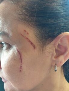 agresion dueña taperia walkirias